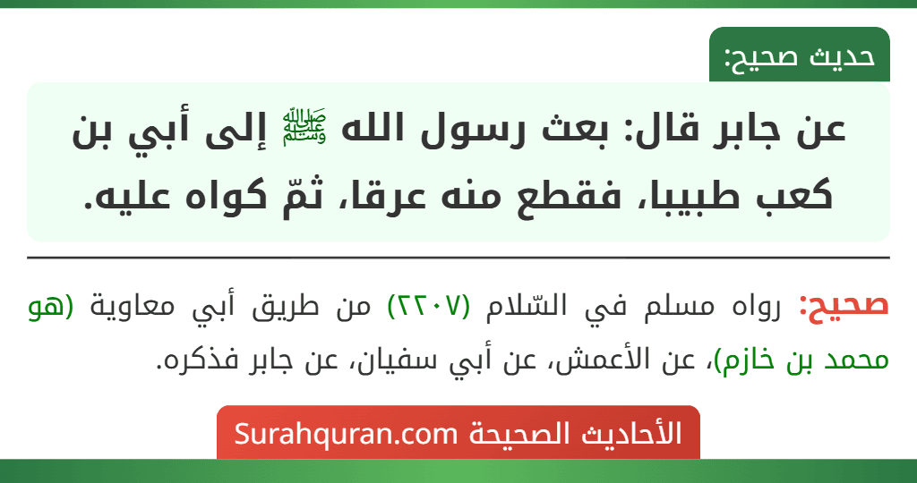 عن جابر قال: بعث رسول الله ﷺ إلى أبي بن كعب طبيبا، فقطع منه عرقا، ثمّ كواه عليه.