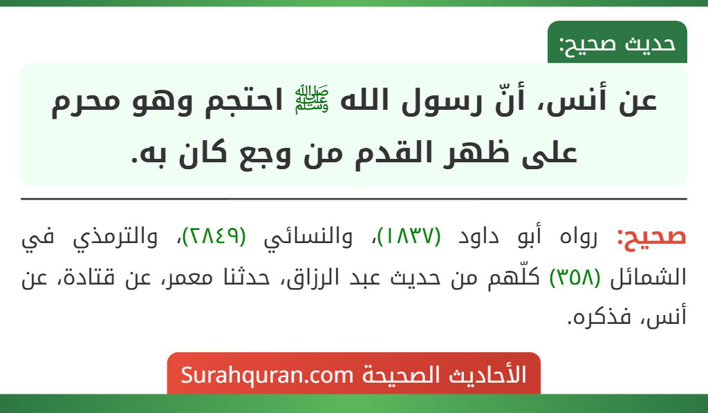 عن أنس، أنّ رسول الله ﷺ احتجم وهو محرم على ظهر القدم من وجع كان به.