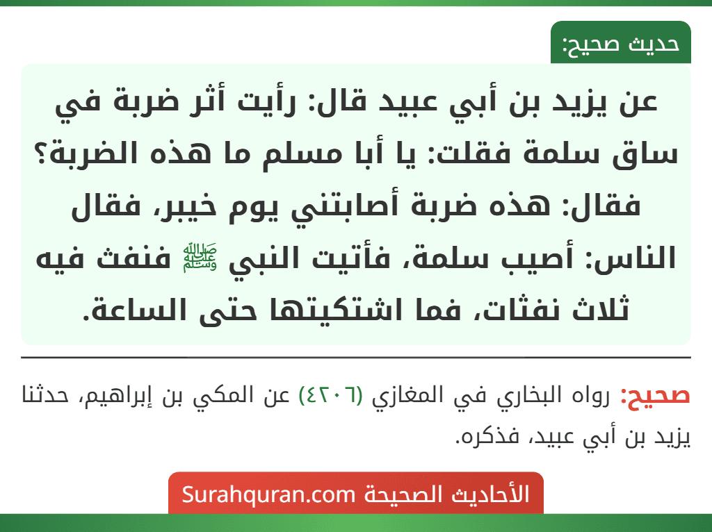 عن يزيد بن أبي عبيد قال: رأيت أثر ضربة في ساق سلمة فقلت: يا أبا مسلم ما هذه الضربة؟ فقال: هذه ضربة أصابتني يوم خيبر، فقال الناس: أصيب سلمة، فأتيت النبي ﷺ فنفث فيه ثلاث نفثات، فما اشتكيتها حتى الساعة. عن يزيد بن أبي عبيد قال: رأيت أثر ضربة في ساق سلمة فقلت: يا أبا مسلم ما هذه الضربة؟ فقال: هذه ضربة أصابتني يوم خيبر، فقال الناس: أصيب سلمة، فأتيت النبي ﷺ فنفث فيه ثلاث نفثات، فما اشتكيتها حتى الساعة.